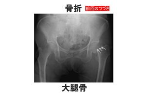 不安と不満がピークに達すると、感謝を忘れる、の回