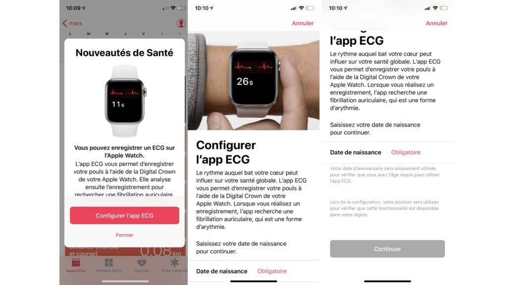 Configuration électrocardiogramme sur l'Apple Watch // Source : Numerama