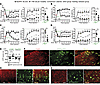 Analgesia of DRG-AAV6-NaViPA1 treatment in female TNI rats.