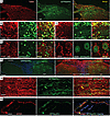 IHC of GFP-NaViPA1 and target gene expression.