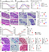 Loss of Ire1α in ILC3s impedes recovery from acute DSS colitis and exacerba