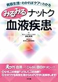 みるみるナットク血液疾患―病態生理がわかればケアがわかる