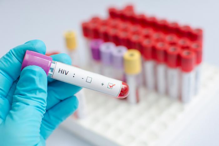 HIV blood sample