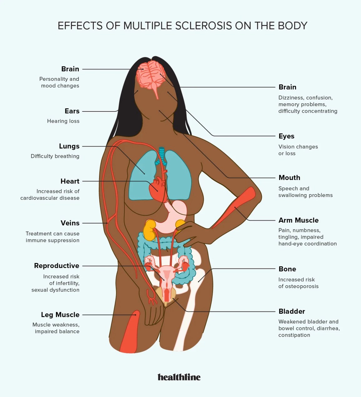 Multiple sclerosis effects on the body infographic