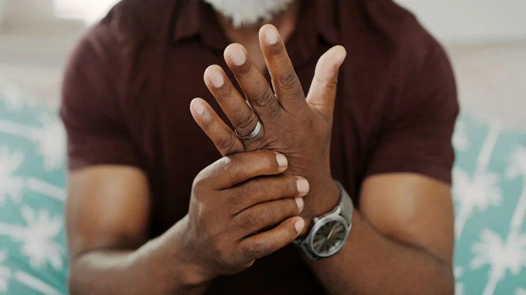 A close-up photo of finger swelling caused my arthritis.