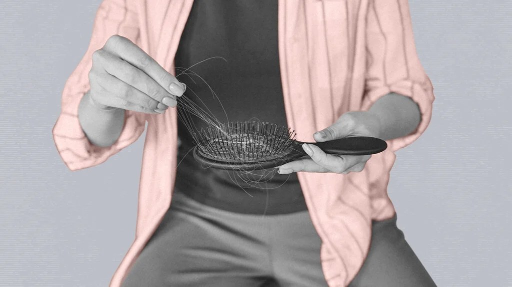 A person experiencing hair loss, taking out hair from their hairbrush.