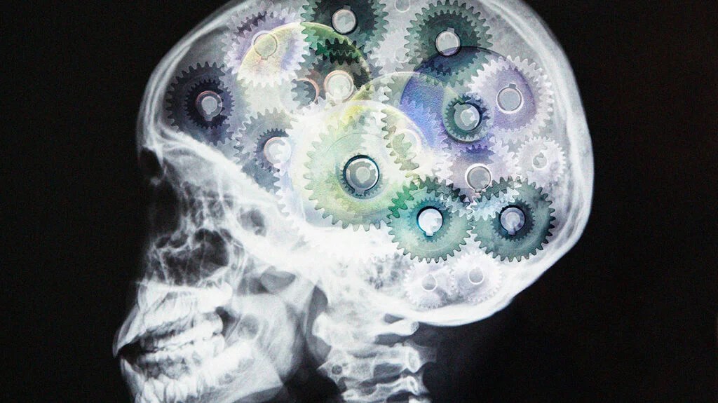 X-ray of skull with cogs as brain, digital montage