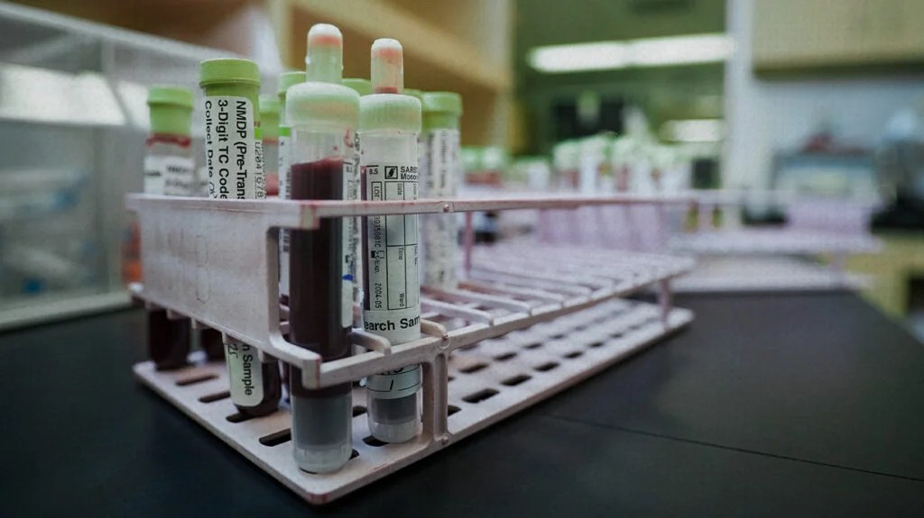 blood samples in tray