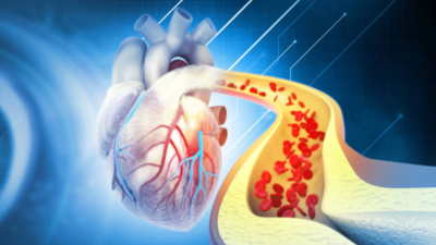 Why cholesterol level rises during winter season