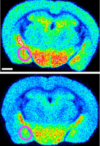 病は気から？　体と心の不調、不安、免疫にかかわる分子解明　阪大