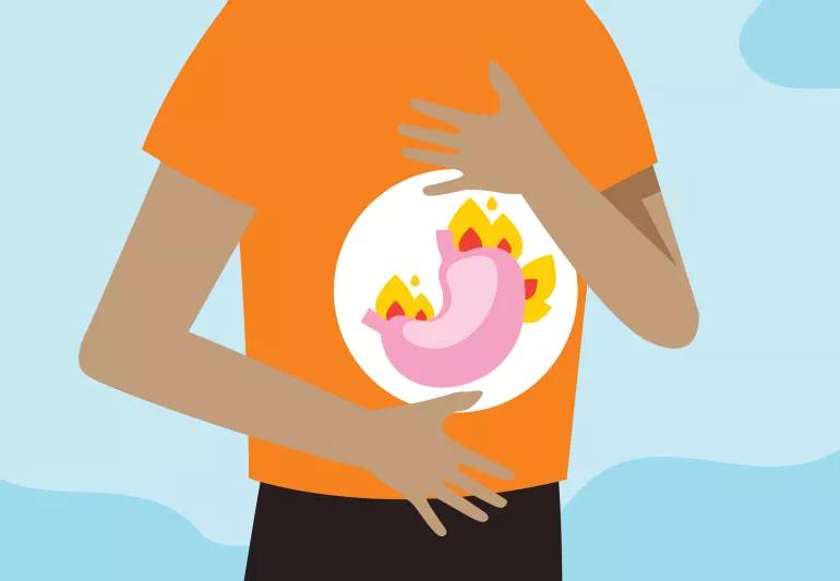 Illustration of man with heartburn