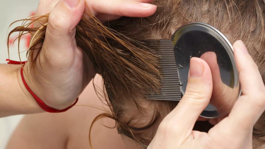 parent checking child's hair for lice