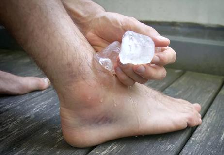 Treating sprain with ice