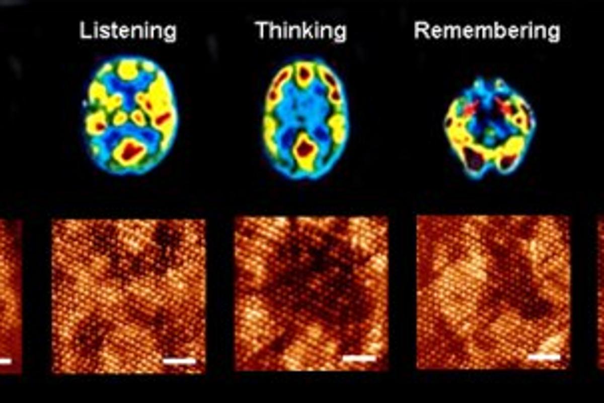 Researchers have succeeded in building a molecular computer that can mimic the inner working mechanisms of the human brain