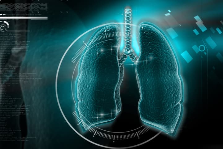 Researchers have created an AI algorithm that can detect COVID-19 infection from chest X-rays with 98% accuracy