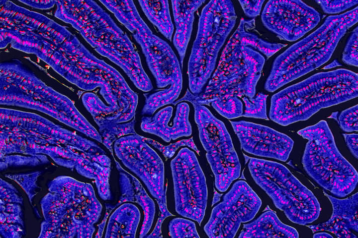 This vibrant image, "Grand Canyon," showing a cross-section of the intestine of a mouse, was an entrant in the Centenary Institute's 'When Art Meets Science' competition