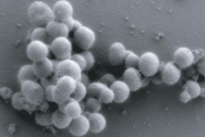 Mycoplasma mycoides JCVI-syn1.0 - the world's first synthetic organism