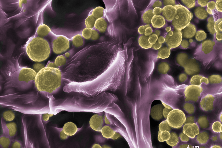 Fashionable fungi: A colored image shows the particles of gold collected by the fungus species fusarium oxsporium