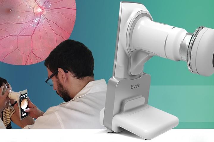 The Eyer itself is already in production, and is in use as a stand-alone device in various locations throughout Brazil