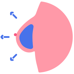 乳房インプラント icon