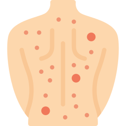 erupção cutânea Ícone