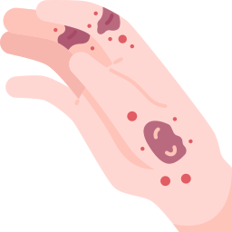 dermatitis icon