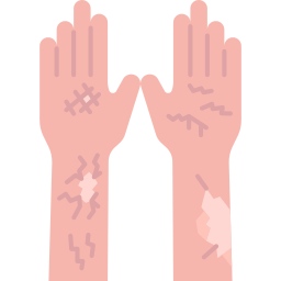 Cracked skin icon