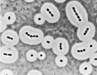 Acinetobacter calcoaceticus