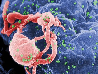 HIV/AIDS; retrovirus