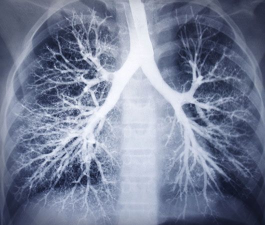 trachea, bronchi, and bronchioles of the human airway tree