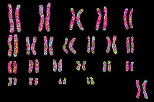 chromosomes