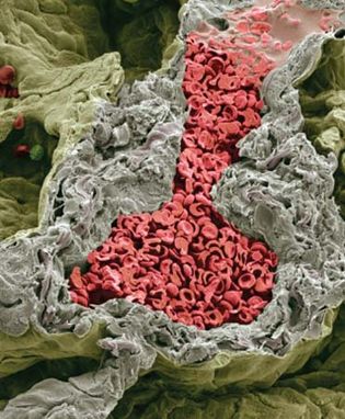 lung capillary