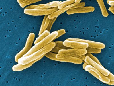 Mycobacterium tuberculosis