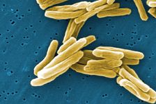 Mycobacterium tuberculosis