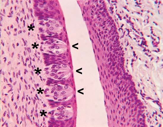 Circumvallate papillae