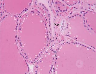 parafollicular cell; thyroid gland