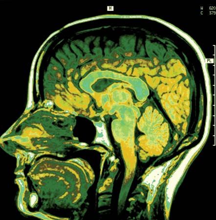 magnetic resonance imaging (MRI)