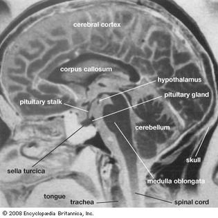 Magnetic resonance imaging (MRI)