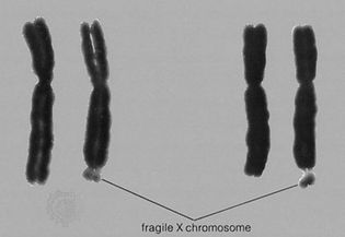 X chromosome