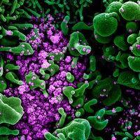 Novel Coronavirus SARS-CoV-2 - Colorized scanning electron micrograph of an apoptotic cell (green) heavily infected with SARS-COV-2 virus particles (purple), isolated from a patient sample. Image captured and color-enhanced at the NIAID Integrated...