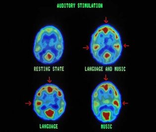 positron emission tomography