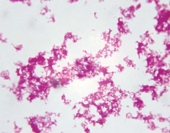 Yersinia pestis