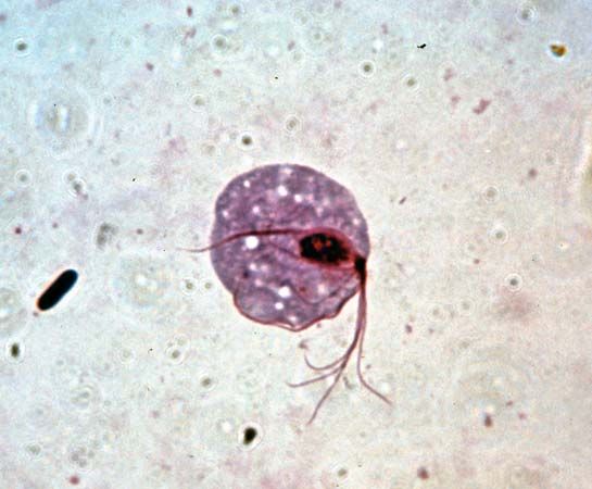 Trichomonas vaginalis