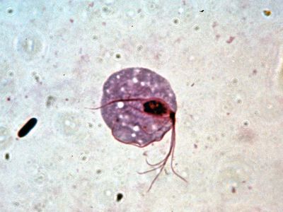 Trichomonas vaginalis