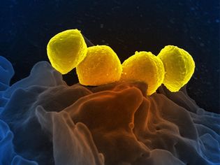 Streptococcus pyogenes