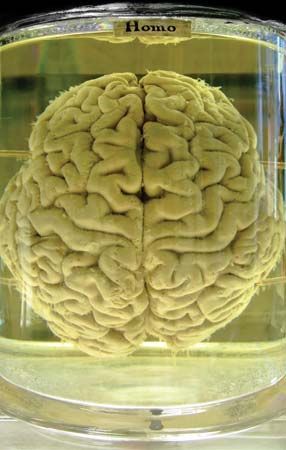 human brain in formalin