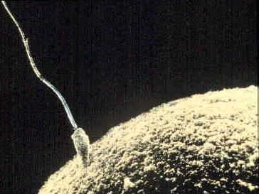 sperm