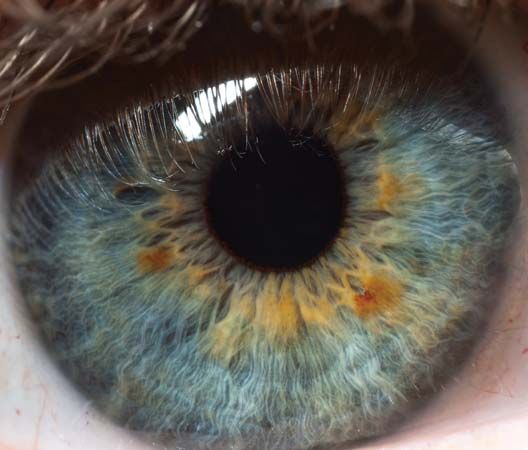 eye