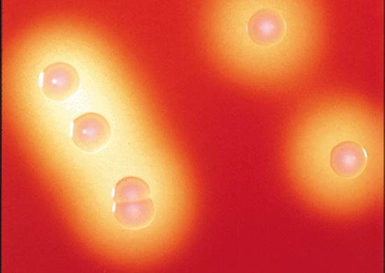 group A beta-hemolytic Streptococcus; rheumatic fever