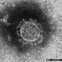 国立感染症研究所が分離した新型コロナウイルスの電子顕微鏡写真＝同研究所提供